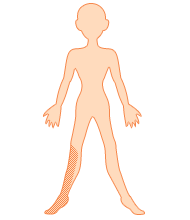 臀部から足の外側、足の裏